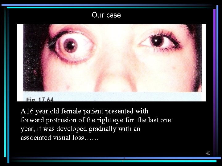 Our case A 16 year old female patient presented with forward protrusion of the