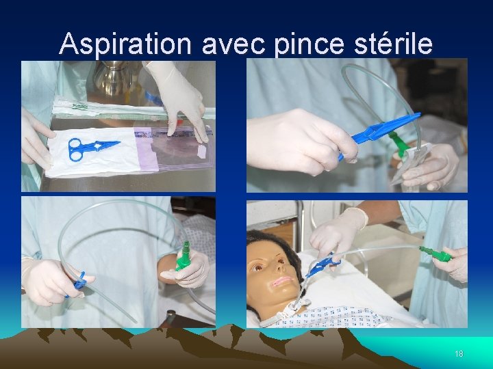 Aspiration avec pince stérile 18 