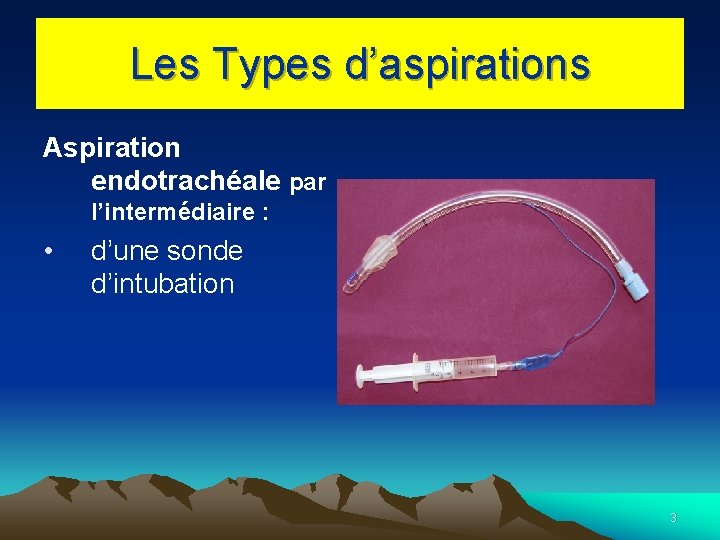 Les Types d’aspirations Aspiration endotrachéale par l’intermédiaire : • d’une sonde d’intubation 3 