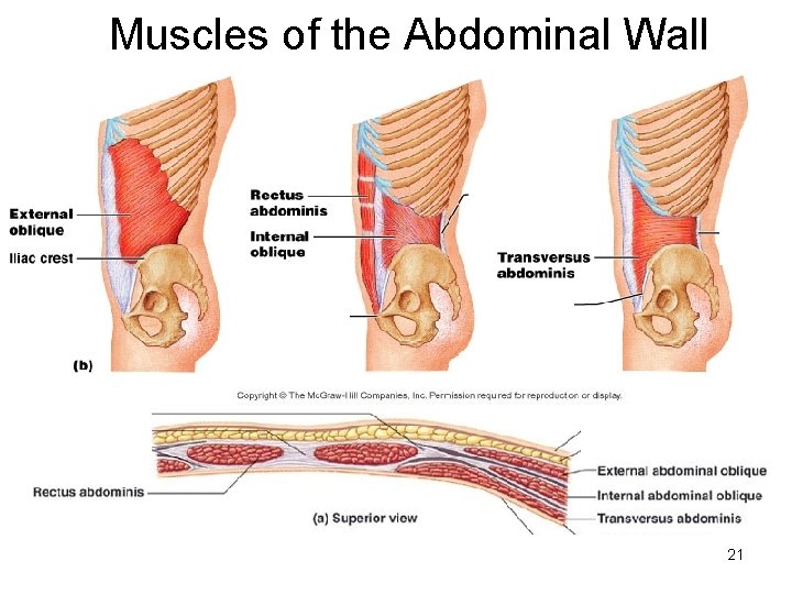 Muscles of the Abdominal Wall 21 