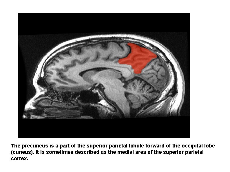 The precuneus is a part of the superior parietal lobule forward of the occipital