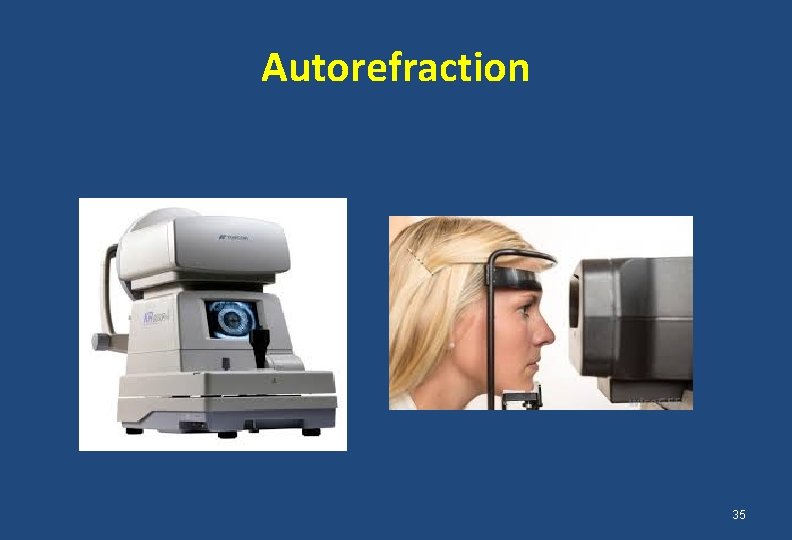 Autorefraction 35 