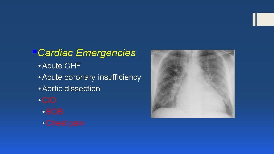 §Cardiac Emergencies • Acute CHF • Acute coronary insufficiency • Aortic dissection • C/O