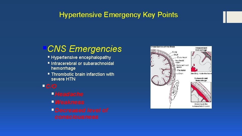 Hypertensive Emergency Key Points §CNS Emergencies § Hypertensive encephalopathy § Intracerebral or subarachnoidal hemorrhage