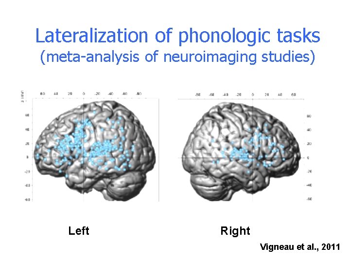 Lateralization of phonologic tasks (meta-analysis of neuroimaging studies) Left Right Vigneau et al. , Lateralization of phonologic tasks (meta-analysis of neuroimaging studies) Left Right Vigneau et al. ,