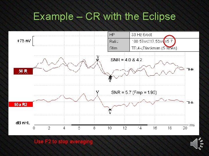 Example – CR with the Eclipse Use F 2 to stop averaging 