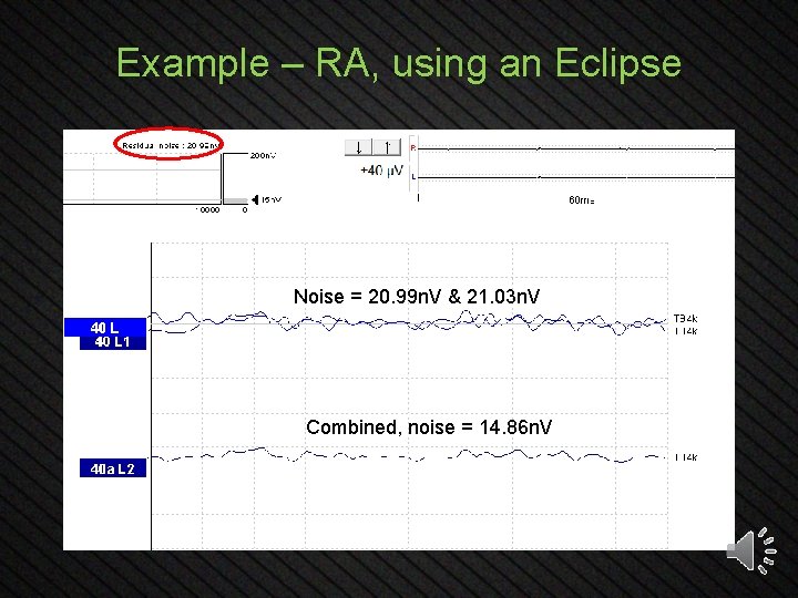 Example – RA, using an Eclipse Noise = 20. 99 n. V & 21.