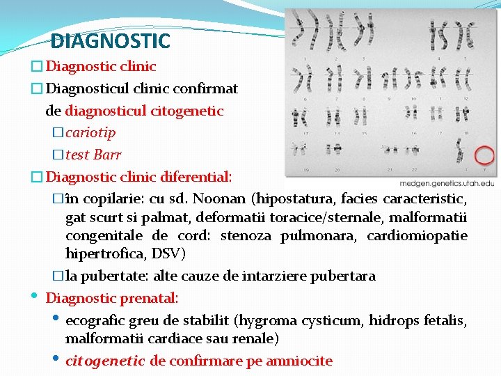 DIAGNOSTIC �Diagnostic clinic �Diagnosticul clinic confirmat de diagnosticul citogenetic �cariotip �test Barr �Diagnostic clinic