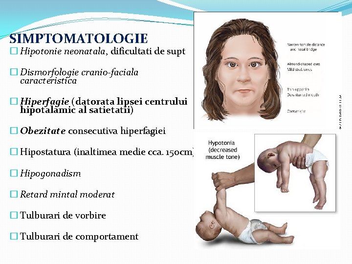 SIMPTOMATOLOGIE � Hipotonie neonatala, dificultati de supt � Dismorfologie cranio-faciala caracteristica � Hiperfagie (datorata