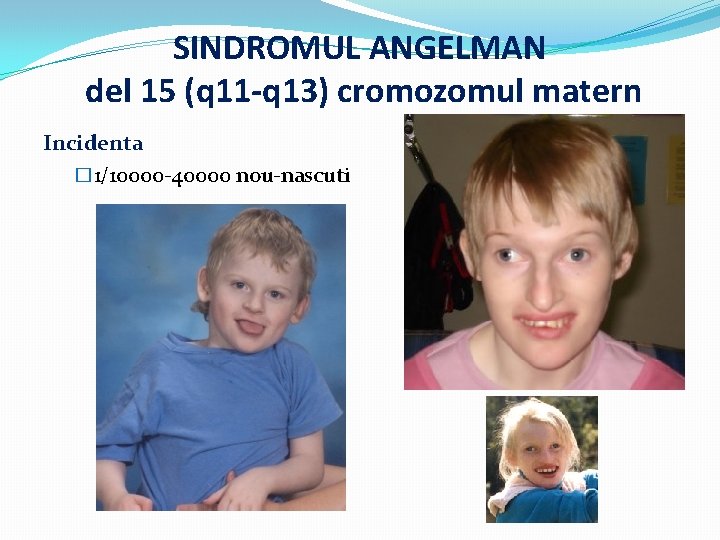 SINDROMUL ANGELMAN del 15 (q 11 -q 13) cromozomul matern Incidenta � 1/10000 -40000