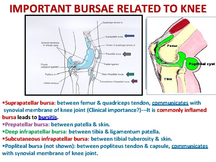 IMPORTANT BURSAE RELATED TO KNEE Suprapatellar Bursitis §Suprapatellar bursa: between femur & quadriceps tendon,