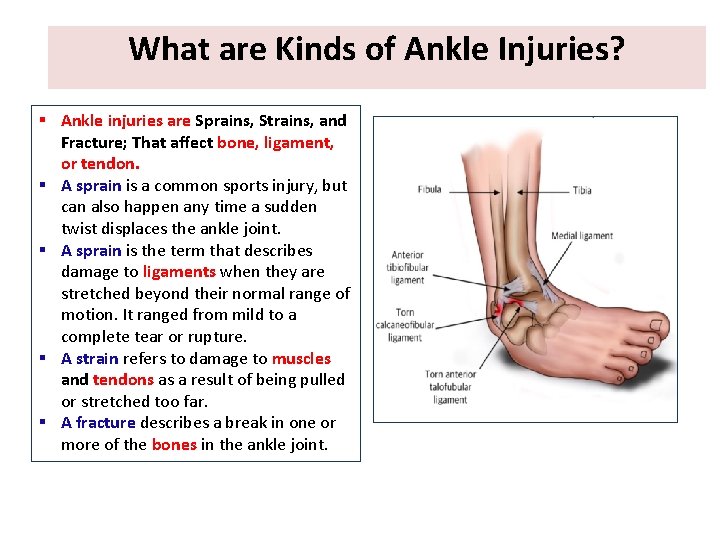 What are Kinds of Ankle Injuries? § Ankle injuries are Sprains, Strains, and Fracture;
