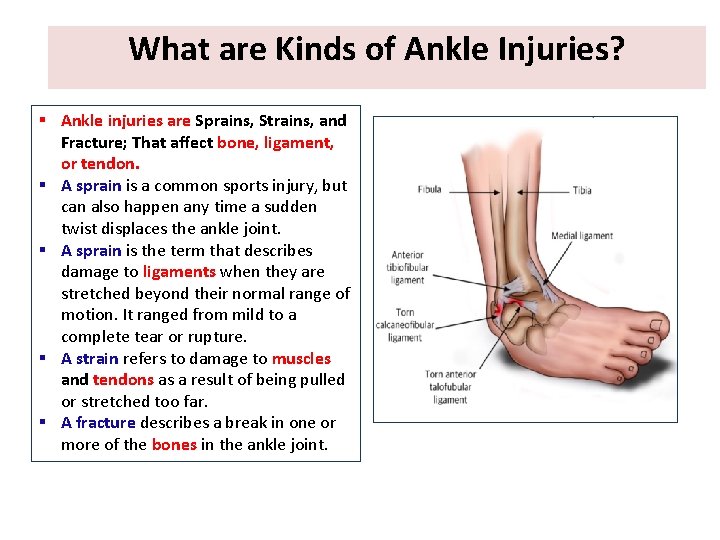 What are Kinds of Ankle Injuries? § Ankle injuries are Sprains, Strains, and Fracture; What are Kinds of Ankle Injuries? § Ankle injuries are Sprains, Strains, and Fracture;
