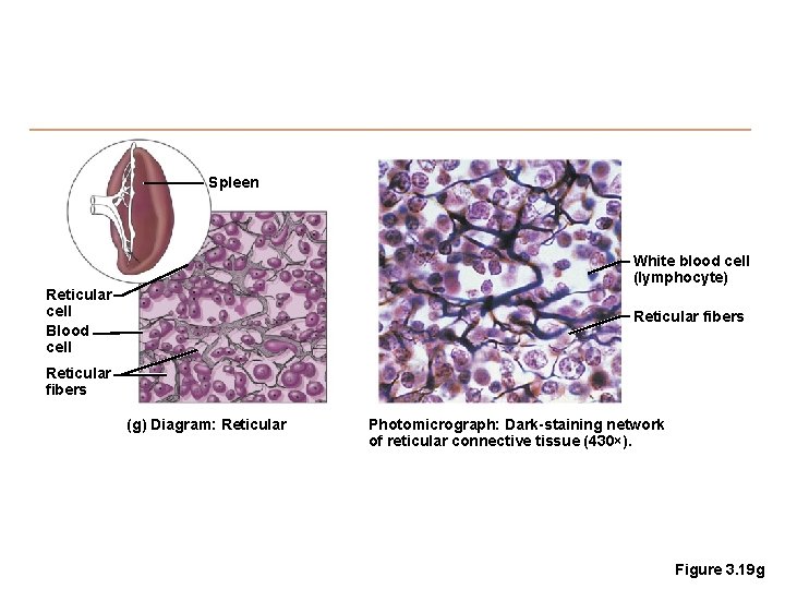 Spleen White blood cell (lymphocyte) Reticular cell Blood cell Reticular fibers (g) Diagram: Reticular