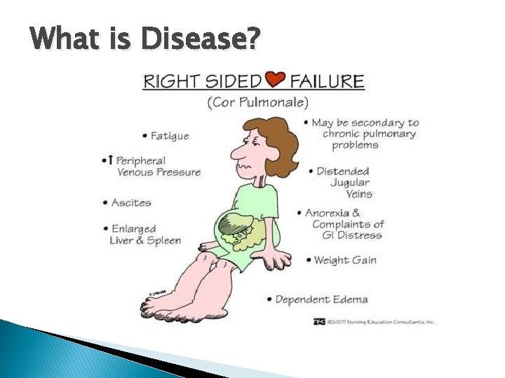 What is Disease? 