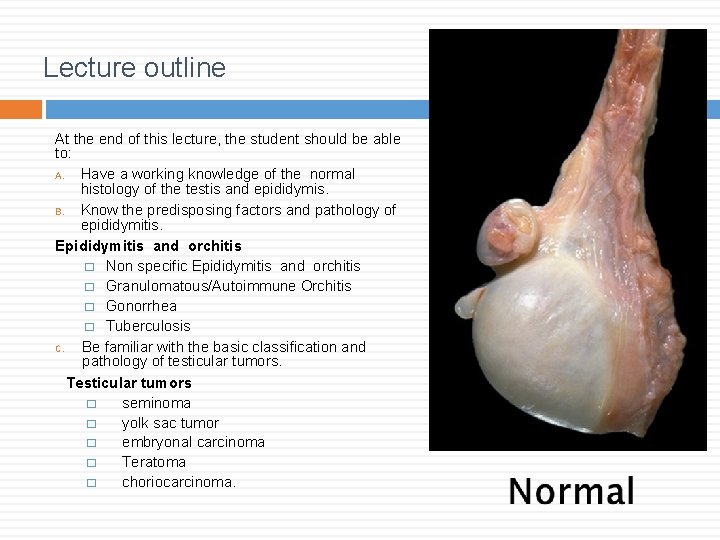 Lecture outline At the end of this lecture, the student should be able to: