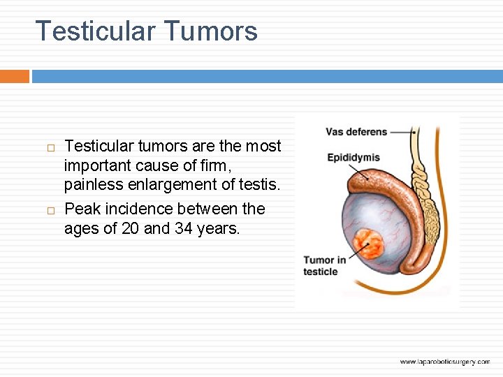 Testicular Tumors Testicular tumors are the most important cause of firm, painless enlargement of