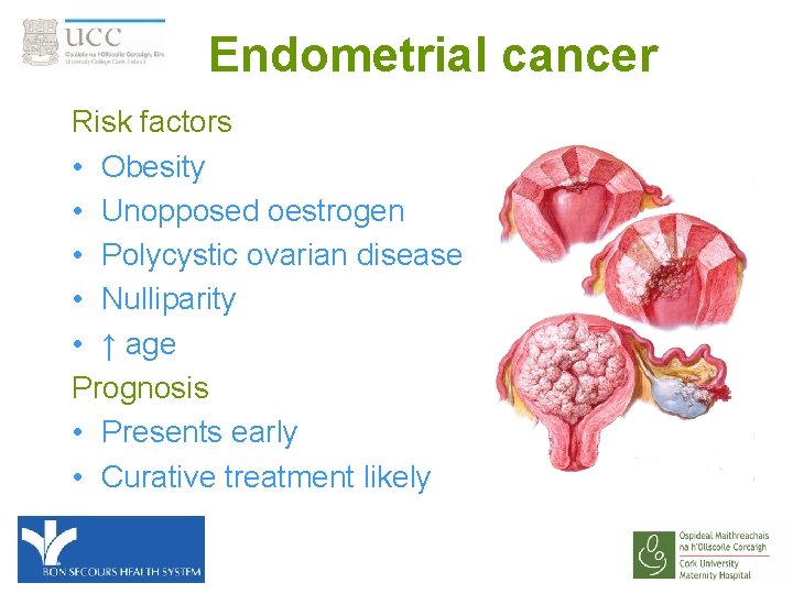 Endometrial cancer Risk factors • Obesity • Unopposed oestrogen • Polycystic ovarian disease •