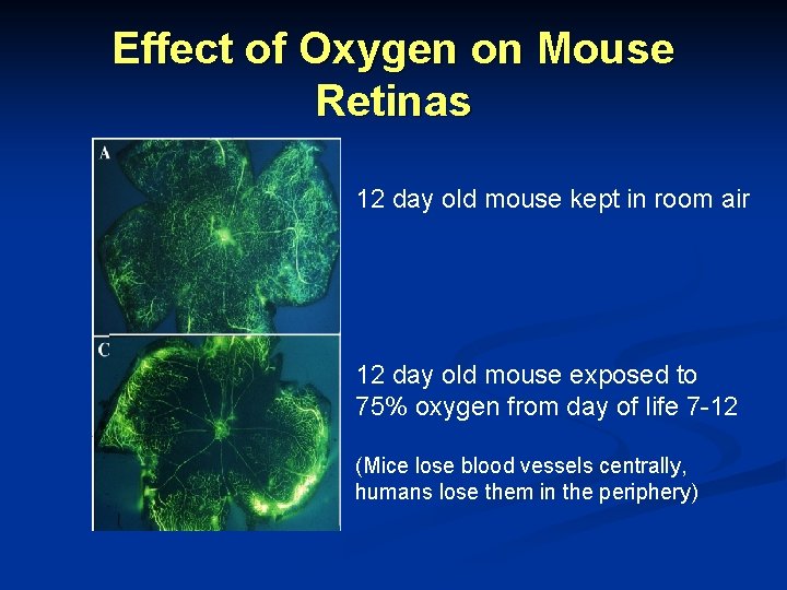 Effect of Oxygen on Mouse Retinas 12 day old mouse kept in room air