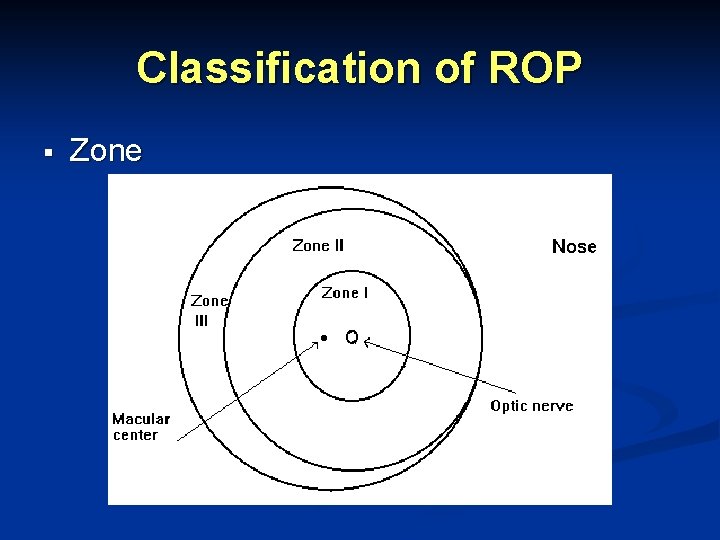 Classification of ROP § Zone 