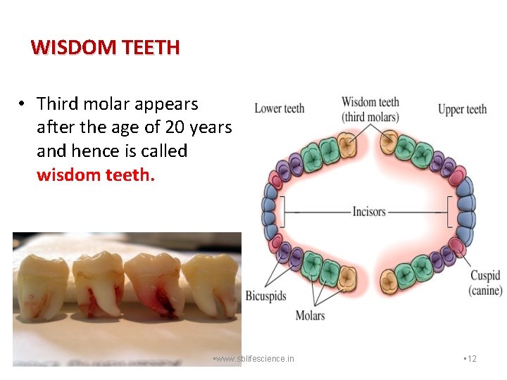 WISDOM TEETH • Third molar appears after the age of 20 years and hence