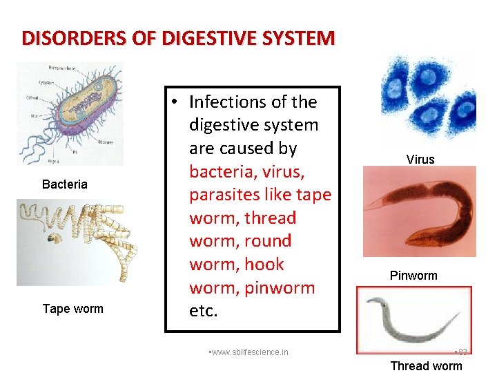 DISORDERS OF DIGESTIVE SYSTEM Bacteria Tape worm • Infections of the digestive system are