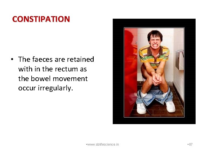 CONSTIPATION • The faeces are retained with in the rectum as the bowel movement