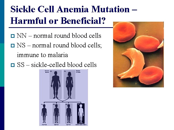 Sickle Cell Anemia Mutation – Harmful or Beneficial? NN – normal round blood cells