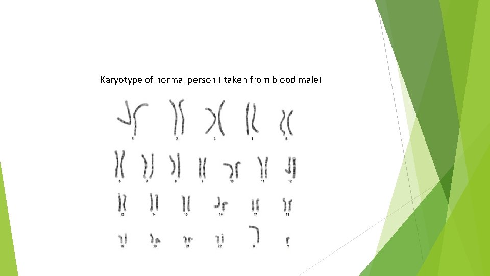 Karyotype of normal person ( taken from blood male) 