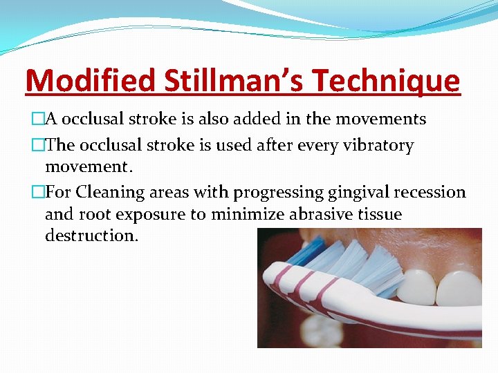 Modified Stillman’s Technique �A occlusal stroke is also added in the movements �The occlusal