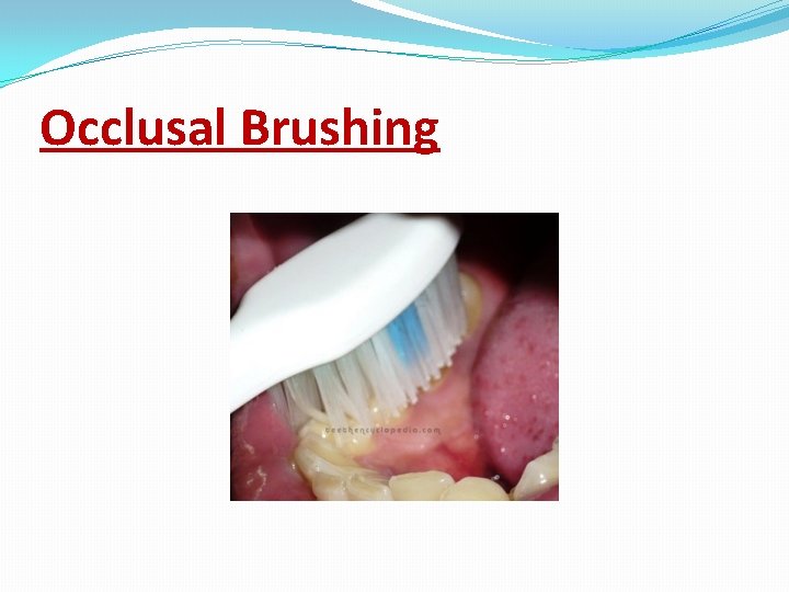Occlusal Brushing 