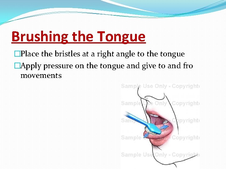 Brushing the Tongue �Place the bristles at a right angle to the tongue �Apply