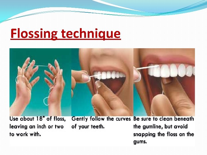 Flossing technique 