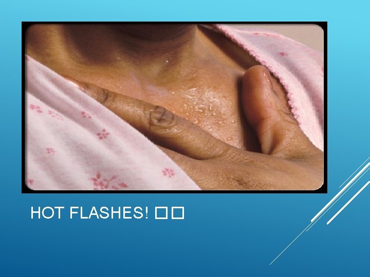 HOT FLASHES! �� 