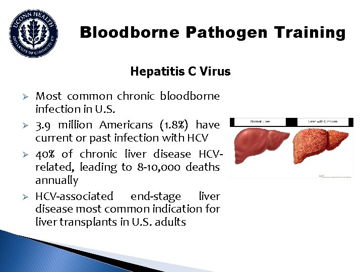 Bloodborne Pathogen Training Hepatitis C Virus Ø Ø Most common chronic bloodborne infection in