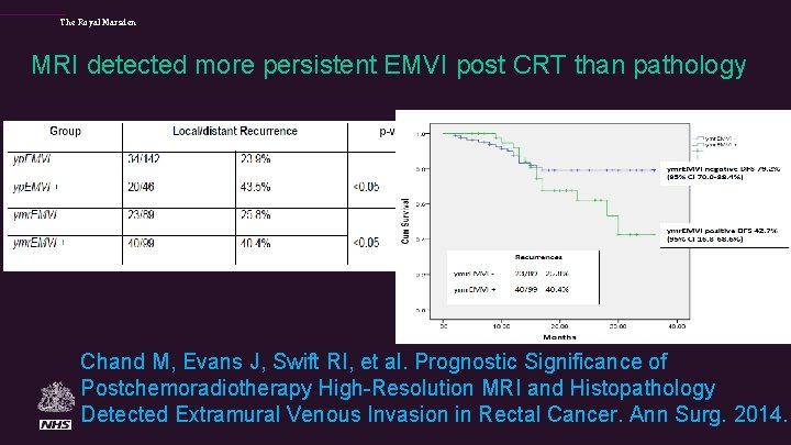 The Royal Marsden MRI detected more persistent EMVI post CRT than pathology Chand M,