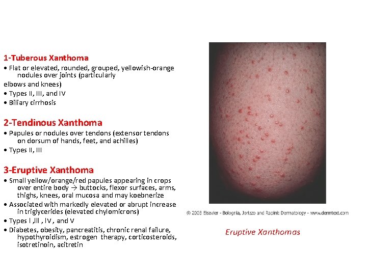 1 -Tuberous Xanthoma • Flat or elevated, rounded, grouped, yellowish-orange nodules over joints (particularly
