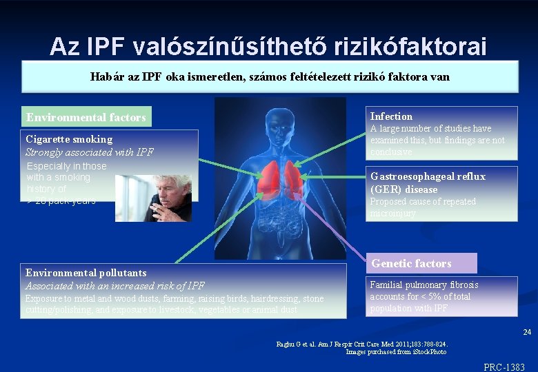Az IPF valószínűsíthető rizikófaktorai Habár az IPF oka ismeretlen, számos feltételezett rizikó faktora van