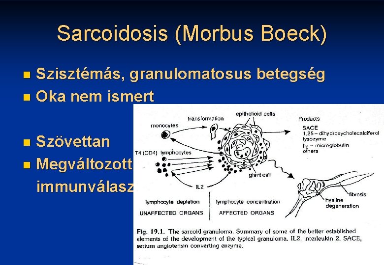 Sarcoidosis (Morbus Boeck) Szisztémás, granulomatosus betegség n Oka nem ismert n Szövettan n Megváltozott