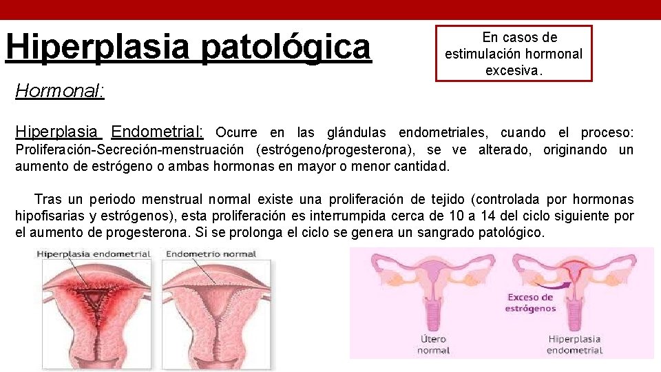 Hiperplasia patológica En casos de estimulación hormonal excesiva. Hormonal: Hiperplasia Endometrial: Ocurre en las