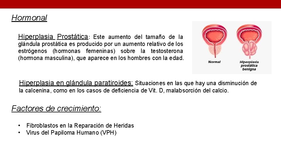 Hormonal Hiperplasia Prostática: Este aumento del tamaño de la glándula prostática es producido por