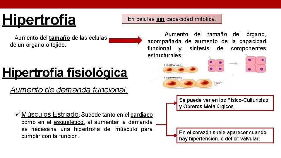 Hipertrofia En células sin capacidad mitótica. Aumento del tamaño de las células de un