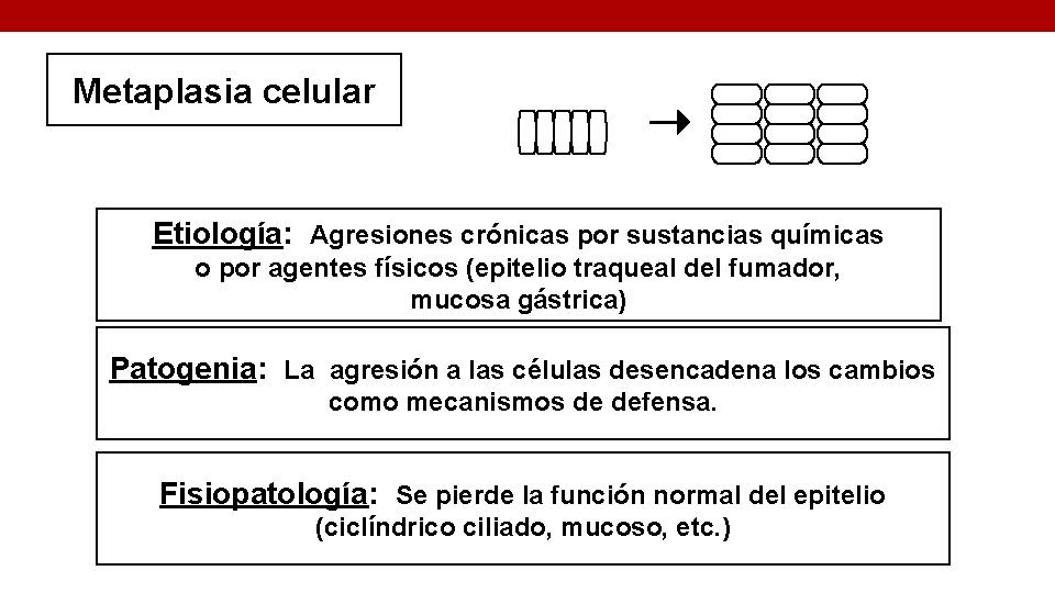 Metaplasia celular Etiología: Agresiones crónicas por sustancias químicas o por agentes físicos (epitelio traqueal
