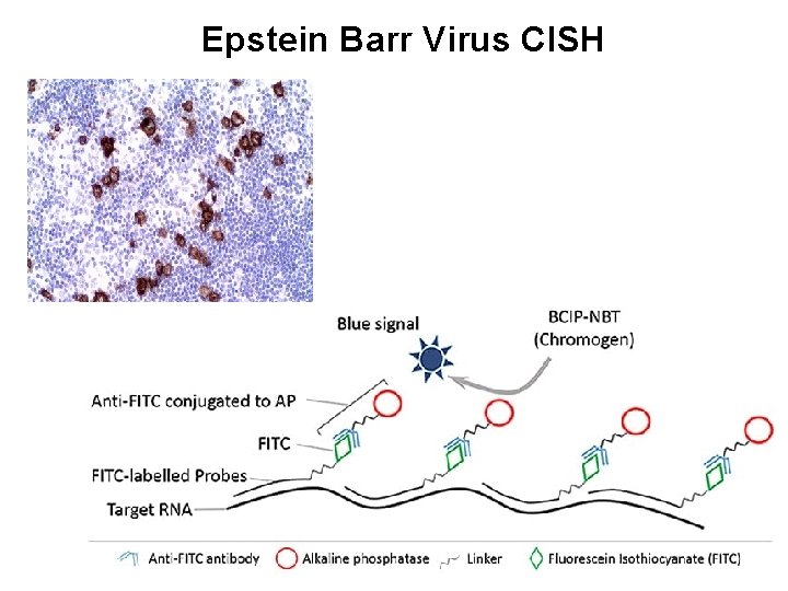 Epstein Barr Virus CISH 