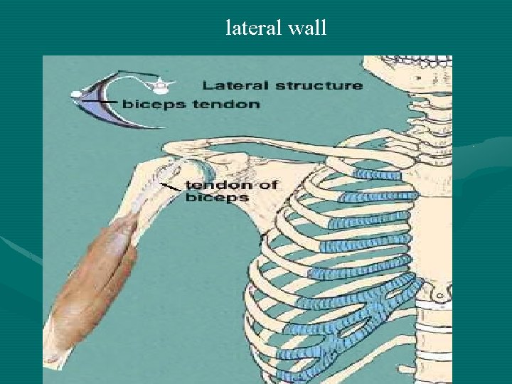 lateral wall 