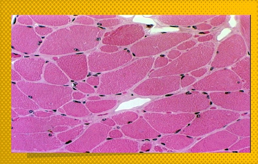 ü Otros tipos de célula presentan múltiples núcleos, por ejemplo: Las células del músculo