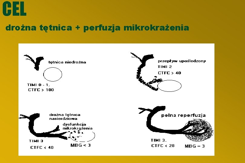 CEL drożna tętnica + perfuzja mikrokrażenia 