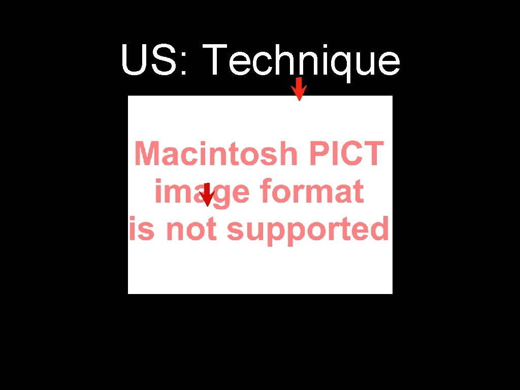 US: Technique 