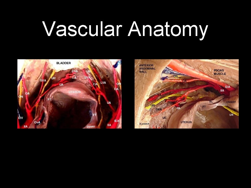 Vascular Anatomy 