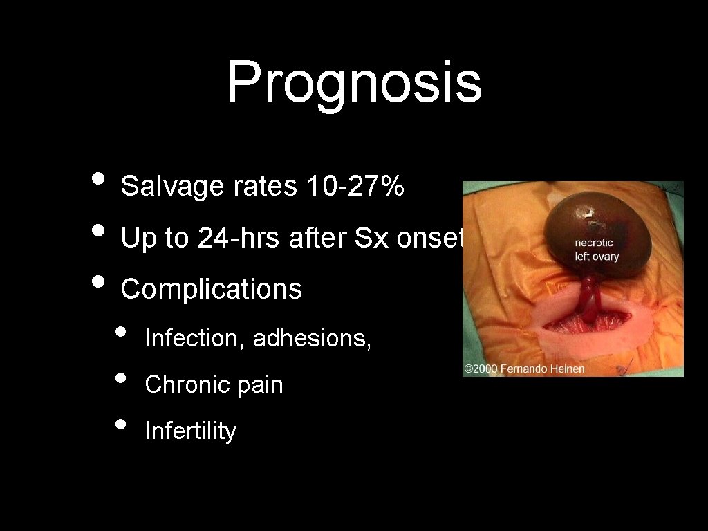 Prognosis • Salvage rates 10 -27% • Up to 24 -hrs after Sx onset